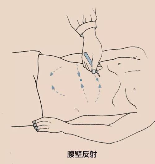 腹壁反射反射弧较长,脊神经后根节前感觉纤维传入的冲动循脊髓上