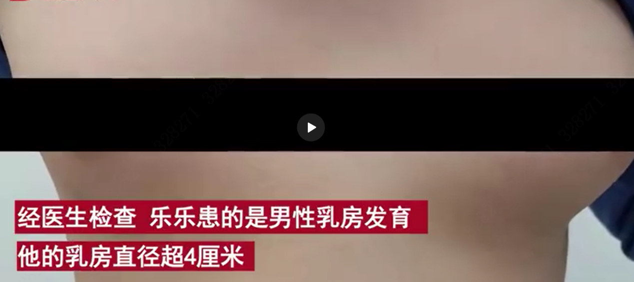 11岁男孩乳房发育直径超4厘米,竟然不是病