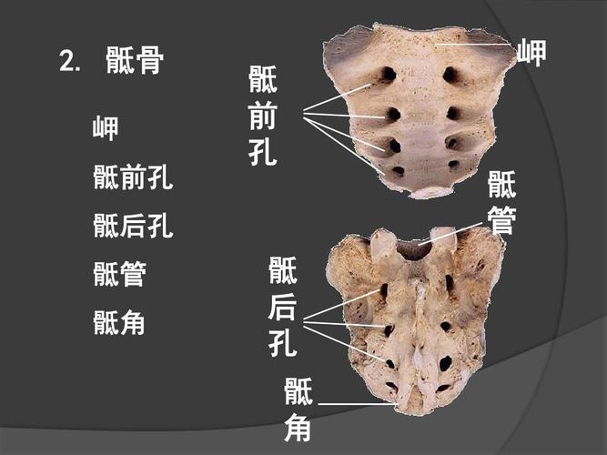  p>骶骨由5块骶椎融合而成,呈三角形,底向上与第五腰椎相连接,上端