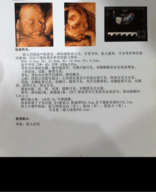 四维大排畸一次通过,猜猜男宝女宝