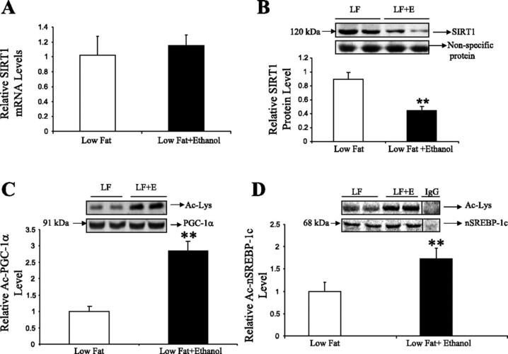 involvement of mammalian sirtuin 1 in the action of ethanol in