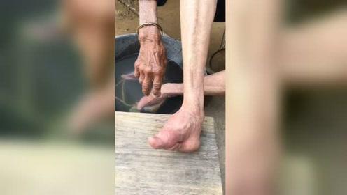 现在还有人在裹脚,三寸金莲的4个指头是软的,不裹就会特别疼