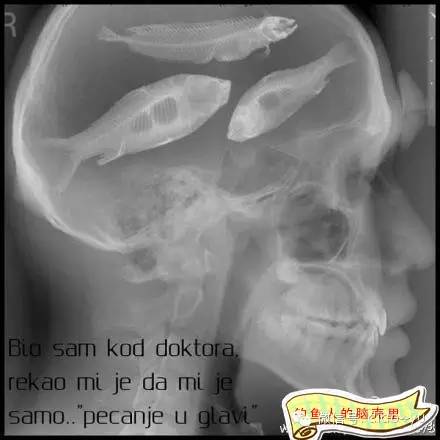 最近感觉身体出了毛病了!去医院拍了ct才找到了病症所在!