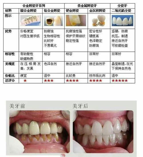 医生,医生怎么我的烤瓷牙上有个黑线,怎么办.