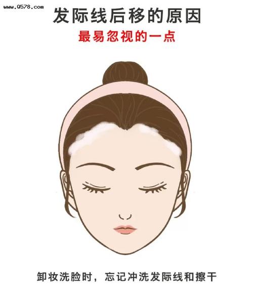 不敢相信!发际线后移竟然和洗脸有关?