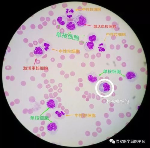 脑脊液单核巨噬细胞的"别样风情"