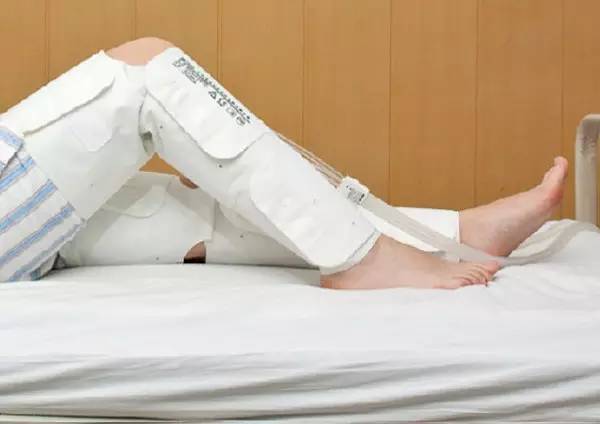 邱医问答 | 打石膏瘦大腿!你在搞笑吗?