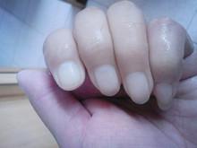 指甲突然变白