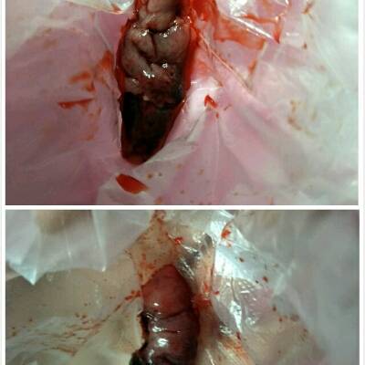 先兆流产,一直流血,今天突然流出一个地方,过了一会又