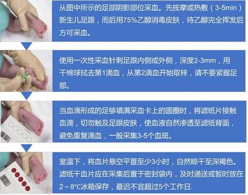 新生儿疾病筛查血片采集练兵场:关于足跟血采集你知道