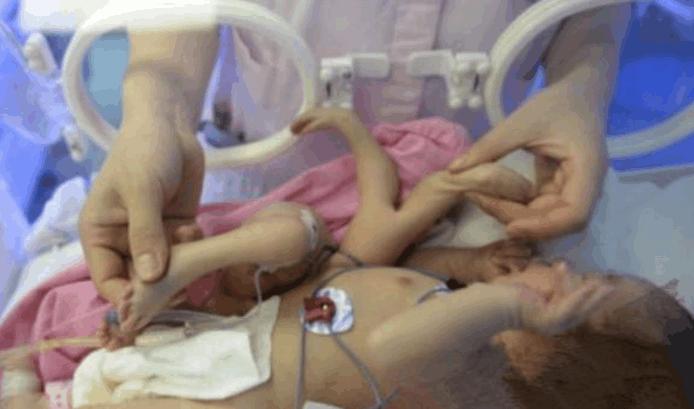 孕35周生宝宝是早产吗 宝宝周生早产妇产科