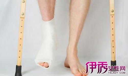 右腿内侧副韧带断裂可大可小 注意事项须牢记