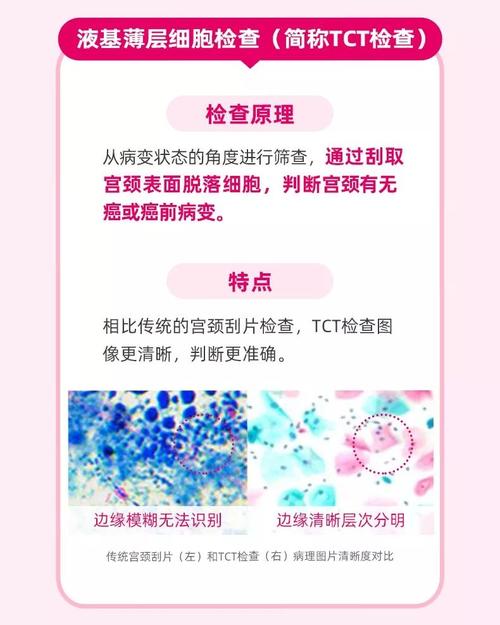 远离女性健康杀手 hpv tct筛查很靠谱