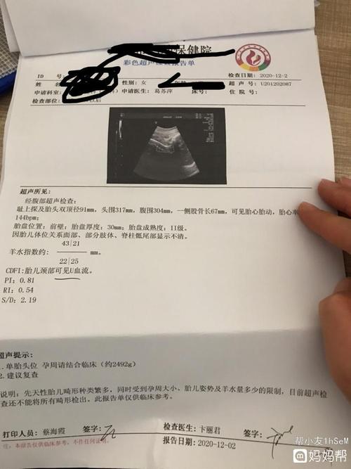 孕35周 胎儿体重多少啊