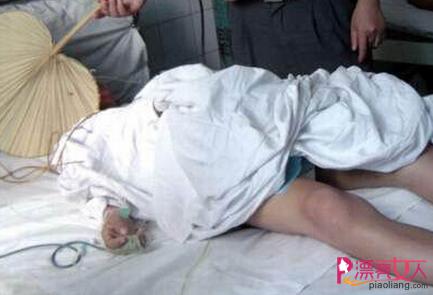 旅馆内做变性手术 在无任何专业医疗设备下切除两侧睾丸