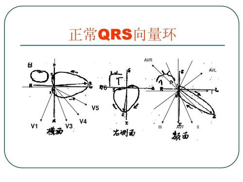 临床心电向量图-沈絮华ppt