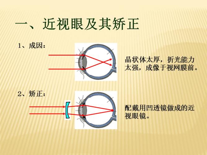 近视眼与远视眼的成因及矫正.ppt