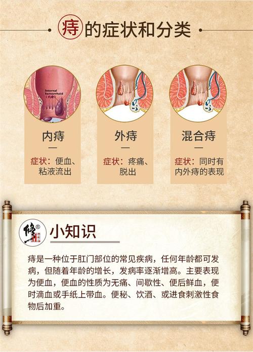修正百草屁舒膏内痔外痔肉球痔疮膏消肉球痔疮凝胶成人20g/支