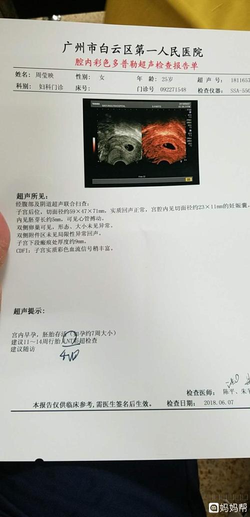 瘢痕子宫图片b超