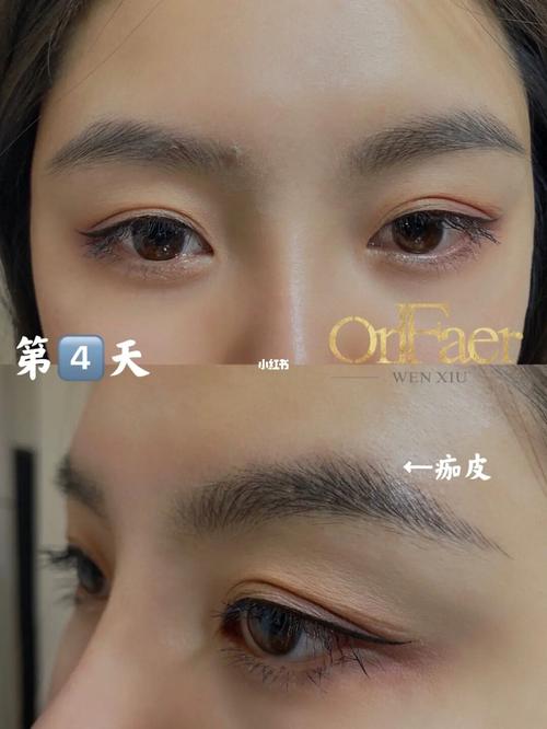 野生眉恢复期上图了_纹眉_野生眉_眉毛_成都纹眉哪里好_美妆_医美整形