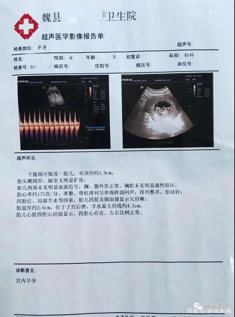 高某检查报告显示其已怀孕(图据燕晚新闻)