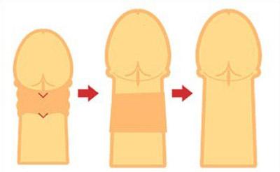 4,阴茎长度的增长法和性能力延长法