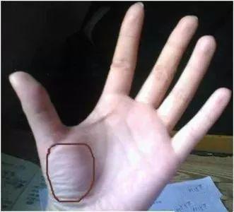 大鱼际在手掌全息图中分布着心脏,且大鱼际处脉络丰富,中医藏象学说