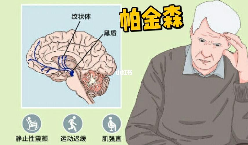 帕金森患者症状有多严重?_增高_滋阴_中医_化痰_运动