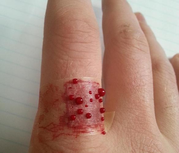 伤口急救要求能够快速止血,止痛,抗菌,防水,说实话,除了氰基丙烯酸酯