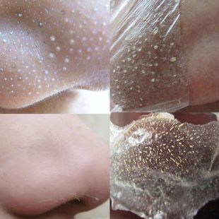 去黑头套装 吸黑头粉刺收缩毛孔祛螨虫鼻贴膜t区男女 花之泪正品