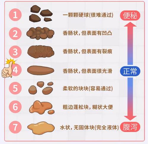 婴儿大便对照表!次数,颜色,形状都清楚,快看你家孩子是否正常
