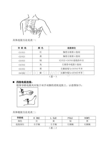 心电图12导联连接彩色示意图