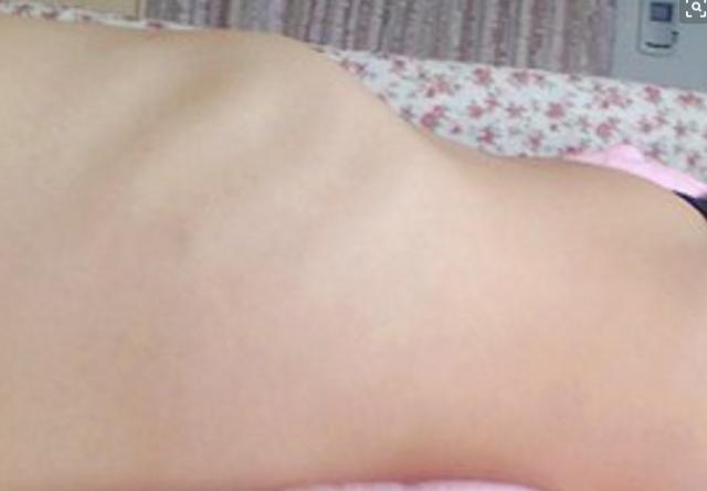 3岁男娃身上突显"鸡胸",医院检查,只因妈妈平时少做了