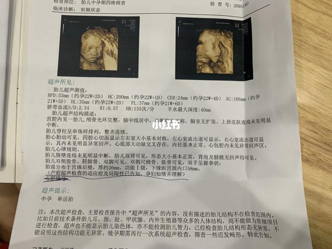 四维彩超_胎儿_孕期_母婴_孕产经验