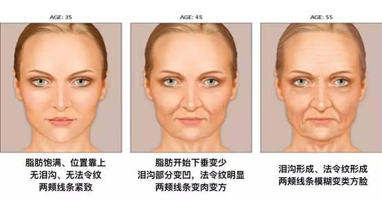 玻尿酸注射翻车毁一生!苹果肌下垂法令纹加深怎么办?