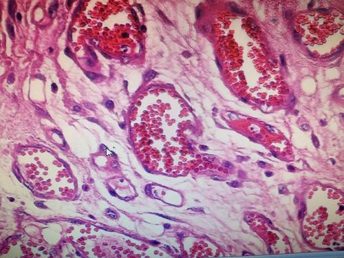 老师展示的肉芽组织切片