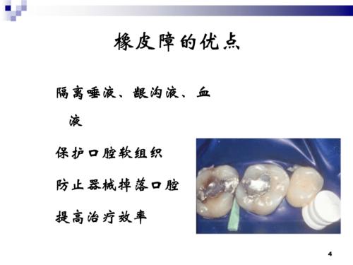 2橡皮障的应用技术方案.ppt 38页