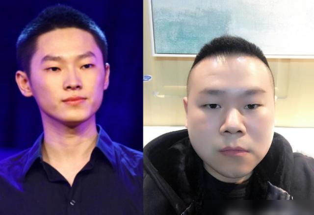 瘦下来的岳云鹏会是什么样子?直到梁博的出现,别放弃治疗还能救