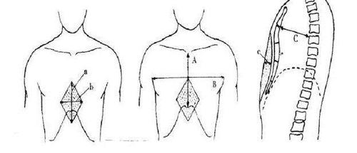 【胸科科普】漏斗胸的检查和测量方法