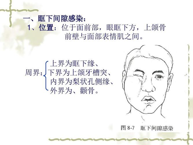 颌面部间隙感染新解ppt