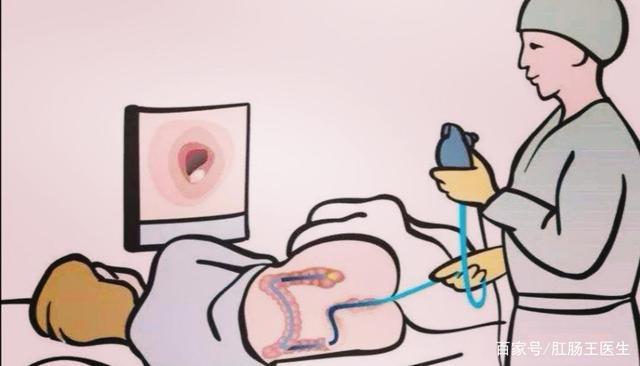 需要做肠镜的患者,在进行检查之前