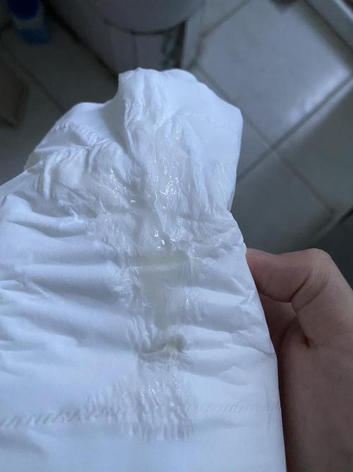 有图慎入,排卵日第二天白带这样正常吗,一连六天白带