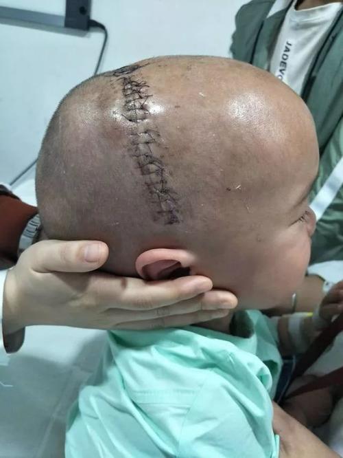 【妇儿科普】咦,宝宝的头型好特别,要当心了哦