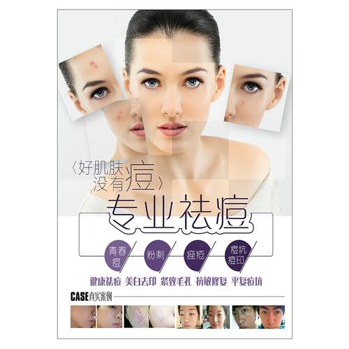 美容院微整形韩式祛斑祛痘广告贴画祛痘美白写真装饰kt板海报1494