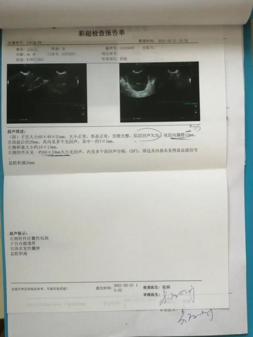 伴随了2年多的卵巢囊肿,她终于决定手术摘除