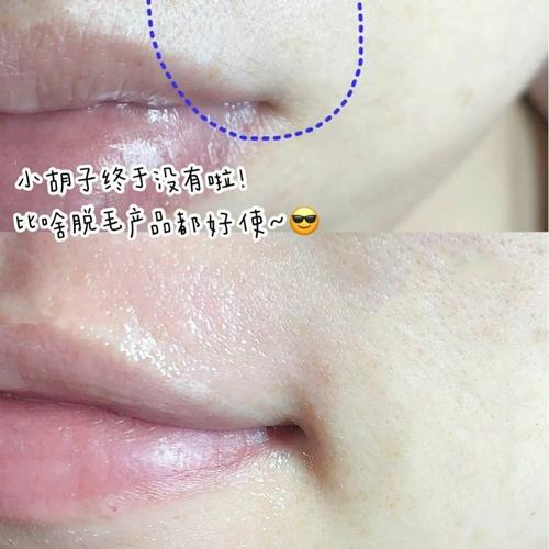 去脸毛神器唇毛脱毛日本唇毛棒拔小胡子面部挽面器绞面器脱毛仪