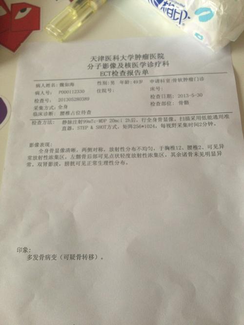 帮忙看看.这ect报告. 可疑骨转移是什么意思?急.高分.
