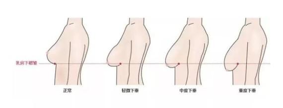 陈小纭因为胸大不能进国家队身材好也有罪