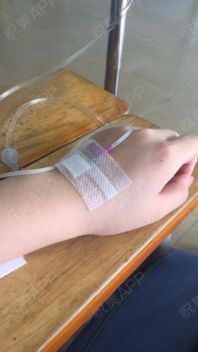 医生打针的手的图片打针手真人打针手打针女生的手打针的图片手真人