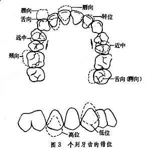 牙齿的分布排列图简笔画